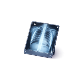 X-Ray
at Home